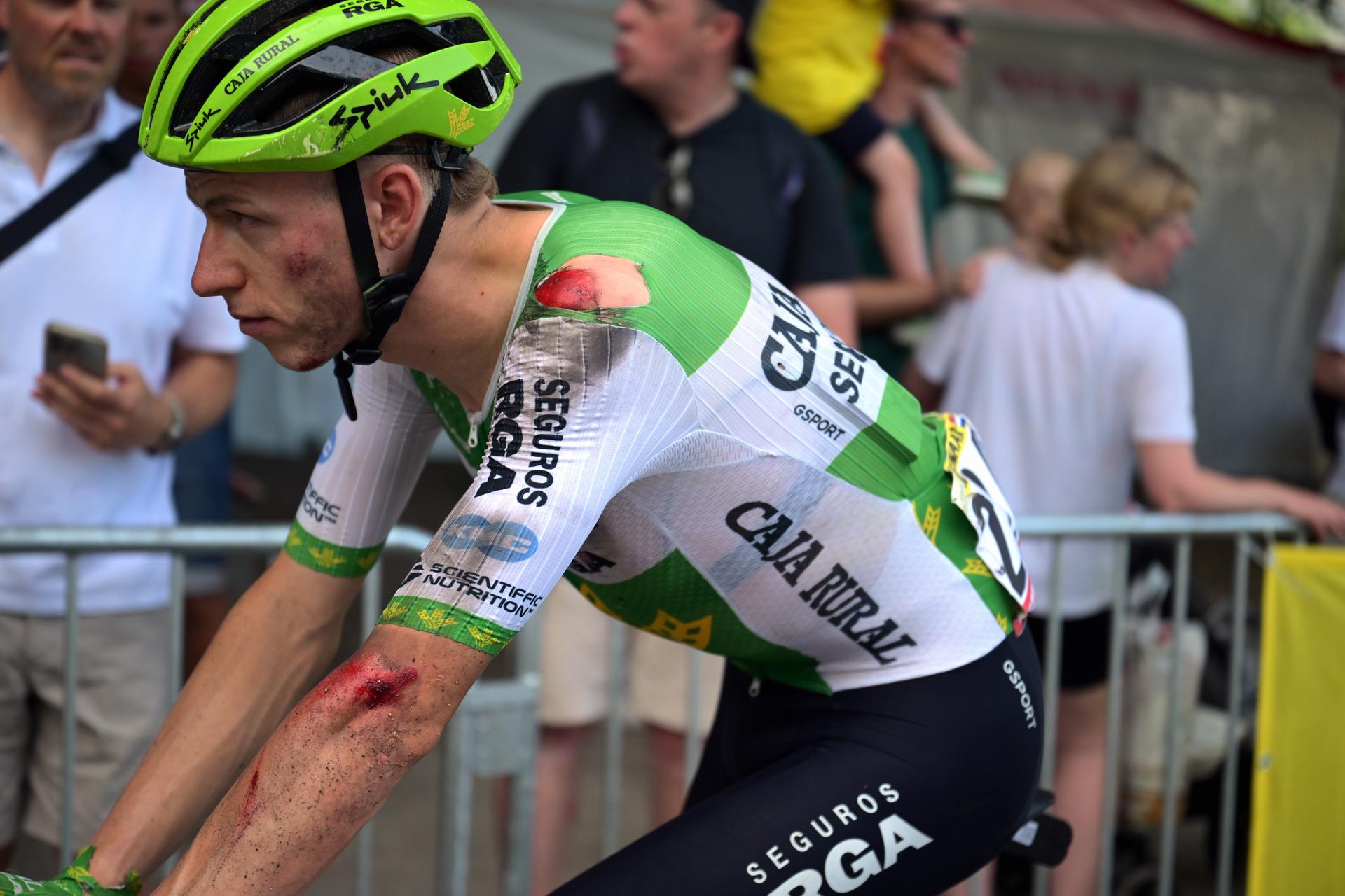 Dutch Alex Molenaar of Caja Rural-Seguros RGA is bruised after a fall at stage 5 of the 2026 Tour de France cycling race, a stage of 158km from Lannemezan to Pau, on Wednesday 08 July 2026. The 113th edition of the Tour de France starts on Saturday 4 July in Barcelona, Spain, and will finish in Paris, France on the 26th of July.  BELGA PHOTO DAVID PINTENS