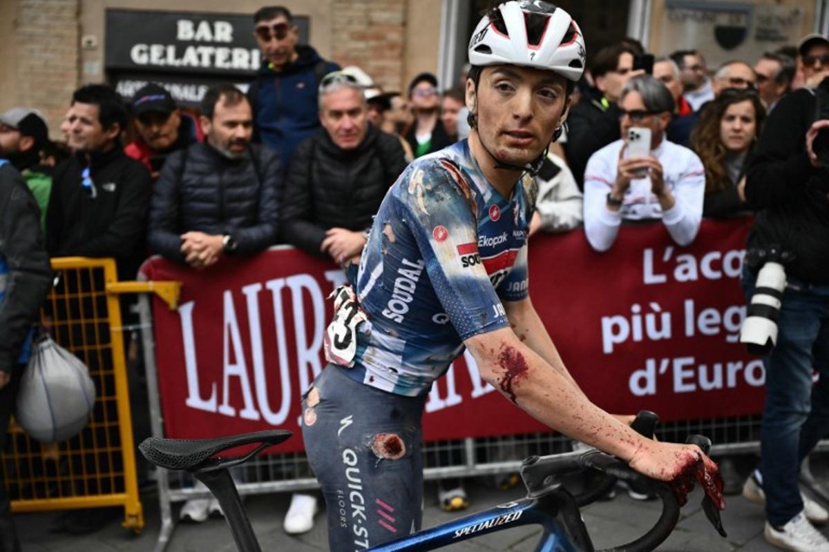 Team Soudal-Quick Step's Italian rider Gianmarco Garofoli looks on with injuries at the end of the 19th one-day classic Strade Bianche (White Roads) men's cycling race between Siena and Siena in Tuscany on March 8, 2025.  Marco BERTORELLO / AFP